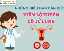 nhung-dieu-ve-viem-lo-tuyen-co-tu-cung-chi-em-can-biet