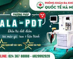 bang-gia-kham-chua-sui-mao-ga-tai-phong-kham-da-khoa-quoc-te-ha-noi-152-xa-dan
