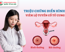 nhung-trieu-chung-viem-lo-tuyen-co-tu-cung-dien-hinh-nhat